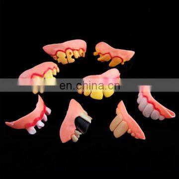 Novelty Items Halloween Props Wholesale Funny Teeth,prank Denture Sets