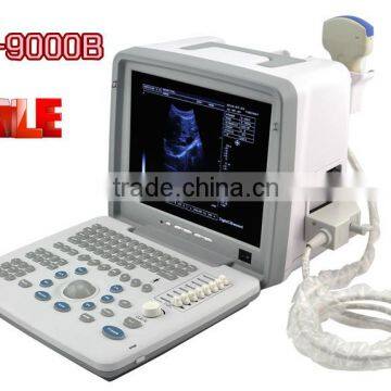 Sale portable Ultrasound Scanner with Convex probe for detecting gynecology obstetrics etc