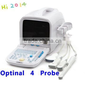 Popular portable Ultrasound Scanner medical equipment optional Convex , Micro-convex,Transvaginal,Linear,Rectal probe