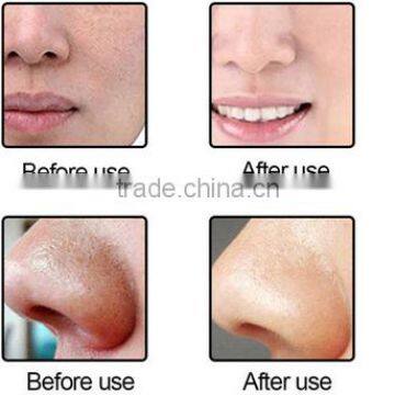 Black Head Remover Machine photo-4