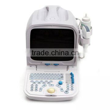 Beautiful Compact Diagnostic Ultrasound Probe / Mini Ultrasound Machine / Portable Ultrasound Scanner photo-3