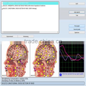 Newest 9d nls Meridian Health Detector Original 9D NLS Health analyzer