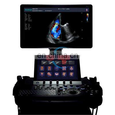 Competitive hospital medical equipment trolley Sonoscape 4d /Ultrasound scanner /Sonoscape S50 Elite