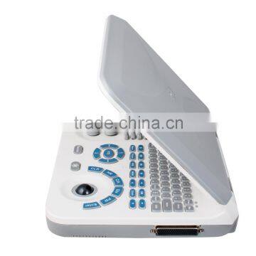 Carejoy Laptop Ultrasound Machine Ultrasound Scanner With Convex Probe RUS-9000F2 by CE ISO Approved photo-2
