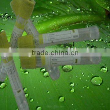 5mlSST tube(CE \ ISO13485 \ ISO9001)