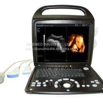 Premium 4D Color Doppler Ultrasound Scanner