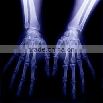 made in china ct film, c-arm x-ray image intensifier,ct,mri manufacturers