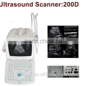 Portable Digital Ultrasound Scanner With SVGA Screen Transvaginal + Convex Probe 200C+ photo-2