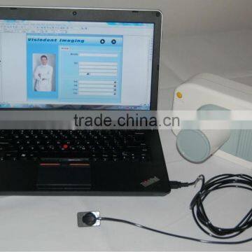 CE approved Dental Portable dental x ray unit