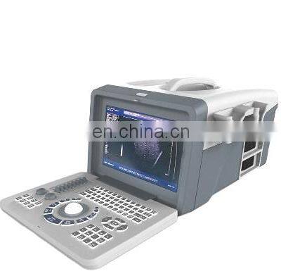 China supplier hot selling portable digital 2D Black white ultrasound machine with certificate