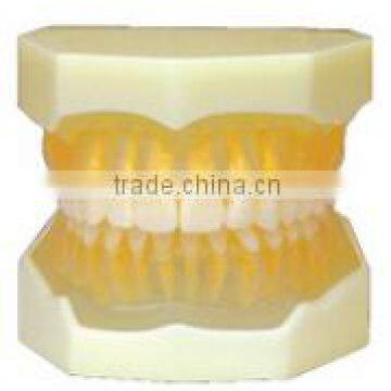 Dental Tooth Extraction Training Model