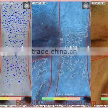 BS-3200 3D Magic Mirror / Skin Analysis / Skin Scope/ Skin Scanner