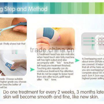 Home Use 808nm Diode Laser Hair Removal Machine for Hair Removal With CE Certification