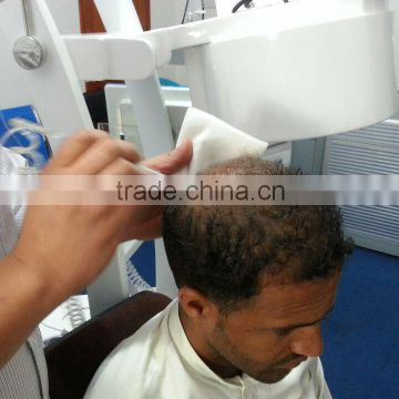 low level laser therapy hair loss/hair loss treatment machine/laser helmet hair loss