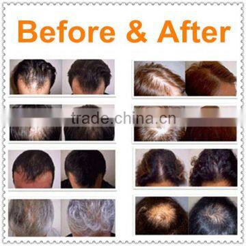 Hair Growth Electric Scalp Stimulator Device photo-6