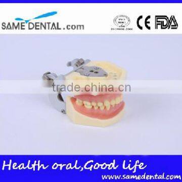 Dental Moderate Periodontal Disease Model Teaching Demonstration