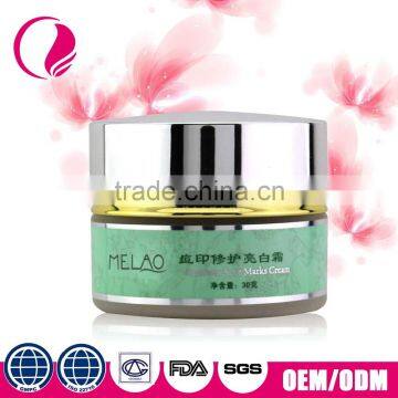 Anti Acne spot Treatment acne scar removal cream for sensitive skin