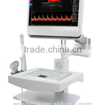 C100 Touch Screen Color Doppler Ultrasound scanner (Hosipital use, Trolley, Sonostar)