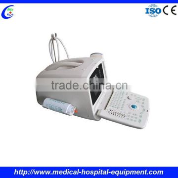 Portable Ultrasound China