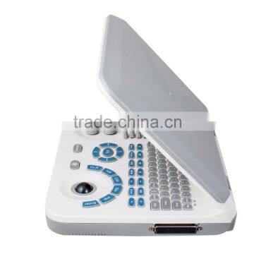 Hot Cheapest Large Screen 10.4 Inch Laptop Ultrasound Scanner Machine With Probe--RUS-9000F2 photo-3