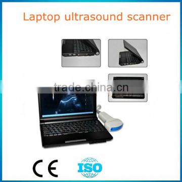 New CE approved Laptop Ultrasound Scanner 10 inch suitable transport