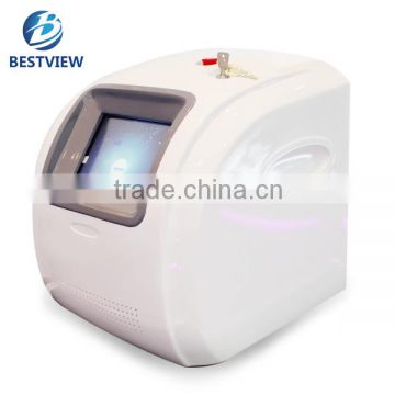 BESTVIEW Professional 980 nm laser treatment for varicose veins in legs