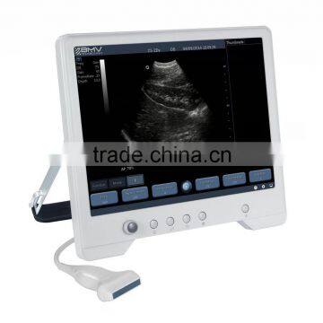 B Mode Portable Ultrasound Price TS20