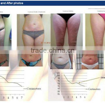 Latest Technology VelaSlim Vacuum Infrared rf Laser Slimming photo-3