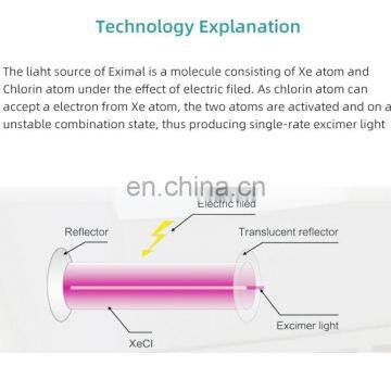 2020 GSD Эксимерный лазер 308нм для лечения псориаза и витилиго. Переносной ламповый источник ультрафиолетового излучения, прибор для УФВ-фототерапии и светотерапии photo-3