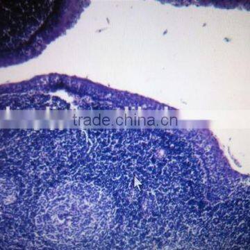 Oral pathological slides