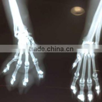 ct scan films of the best products of alibaba , alibaba prices of medical dry film