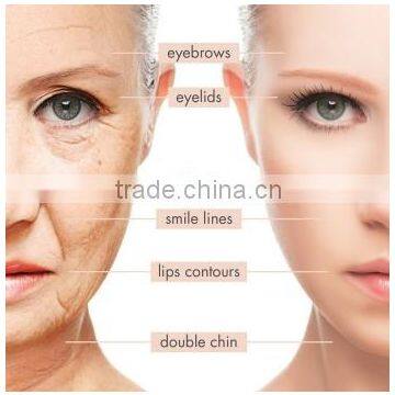 2016 Facial Care SMAS Wrinkle Multi-polar RF Removal Treatment Medical Hifu Machine Painless photo-5