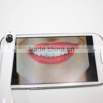 Original 720P Dental Medical Wifi Intra Oral Camera Full hd Oral Camrea Mini Usb Camera photo-2