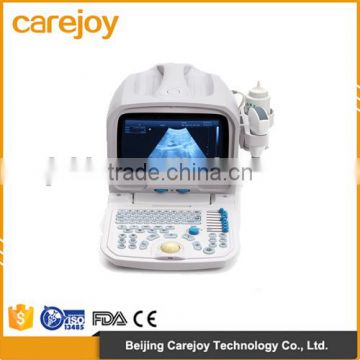 Factory price !!CE approved Portable Ultrasound Scanner with 3.5Mhz multi-frequency convex probe RUS-9000A