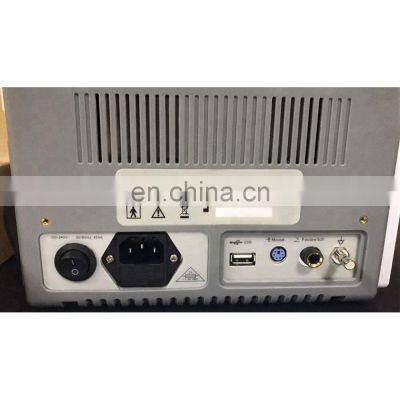 Portable A B Eye Test Ophthalmic Ultrasound Scanner With Touch Screen photo-2