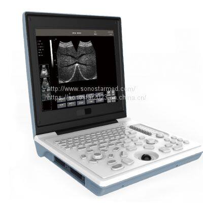 SS-6B Laptop All-Digital Ultrasound photo-4