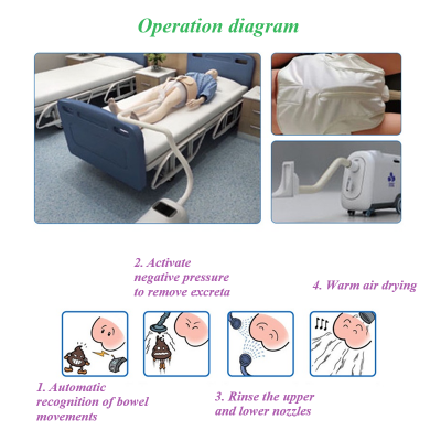 Defecation Care Robot / Care Robot / Intelligent Nurse / Bedridden Disabled Elderly and Disabled / Cleaning Defecation/ photo-5