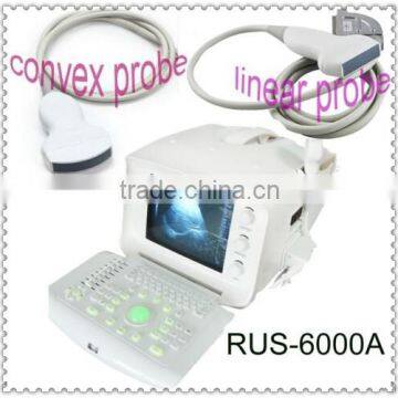 Full Digital Portable Ultrasound Scanner with Convex linear probe RUS-6000A ultrasonic machine medical factory