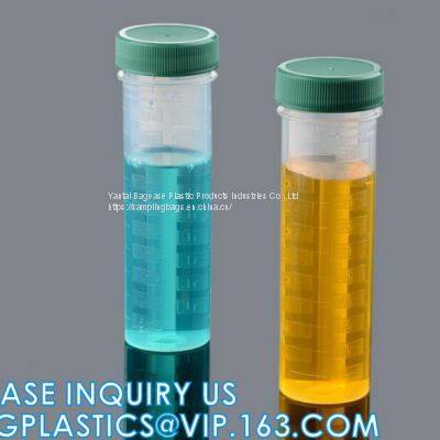 Medical 10ml plastic sampling collection tube Disposable Vacuum Blood Collection Tube, Factory price plastic 10ml 20ml Medical vacuum blood sampling collection tube