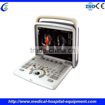 Portable Ultrasound Machine