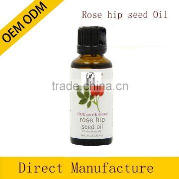 OEM/ODM rosehip seed oil,100% pure rose essential oil offer private labe bulk oil