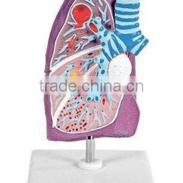 Pathological model of lung