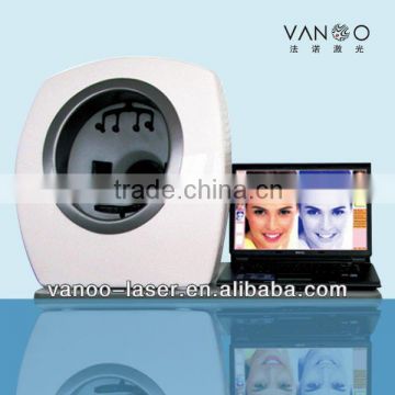 CE approved best skin analyzer / reveal skin analysis machine