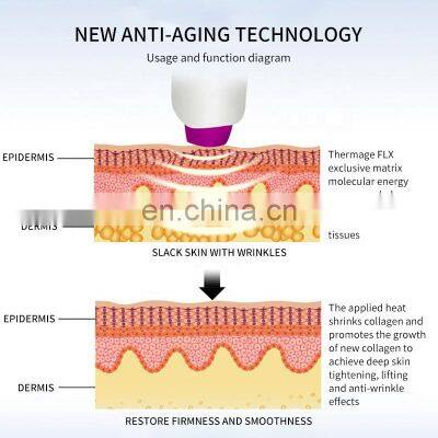 Thermagic FLX Tips Skin Rejuvenation Machine Facial Anti Aging RF Beauty Instrument Body Lifting Treatment Head photo-4