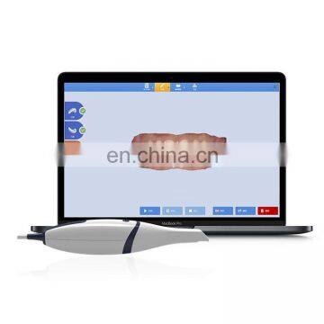 MY-D072 CE Approved Dentist Equipment Intra Oral Camera Portable Dental 3d Intraoral Scanner Price photo-5