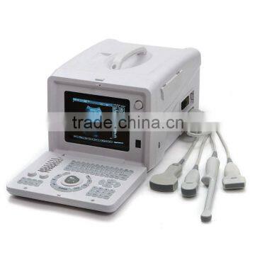 Hot Seller Full Digital Portable Ultrasound Scanner RUS-6000D With Convex Microconvex Probe photo-6