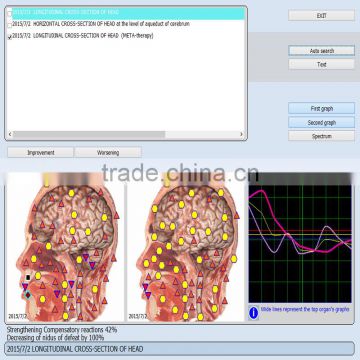 Semi 9d nls automatic biochemistry analyzer Cell Therapy 9D NLS health analyzer