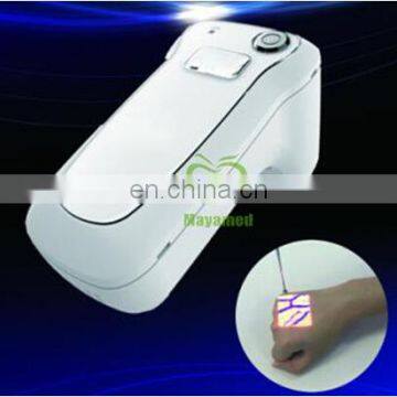 Cheapest Advanced Portable Clinic Handheld Infrared Vein Detector/ Vein Finder for Whole Body Skin Use photo-2