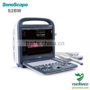 4D Portable Pregnancy Color Doppler Ultrasound Price photo-2