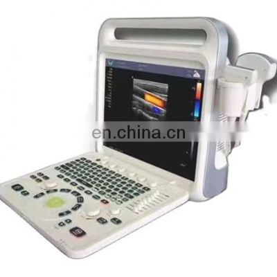 best price  scanner  handheld medical portable laptop black and white ultrasound